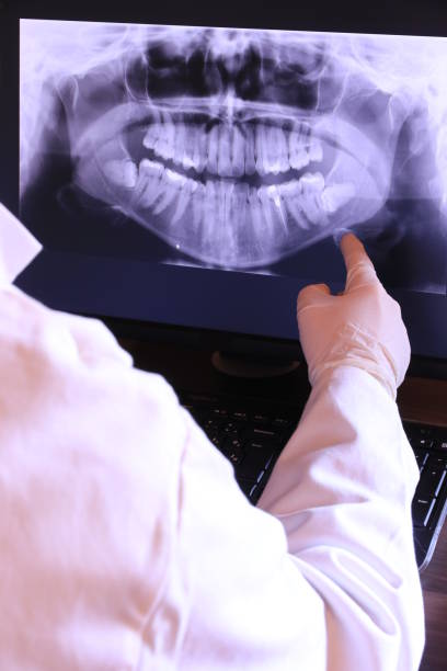 Best Emergency Wisdom Teeth Removal in South Woodstock, CT