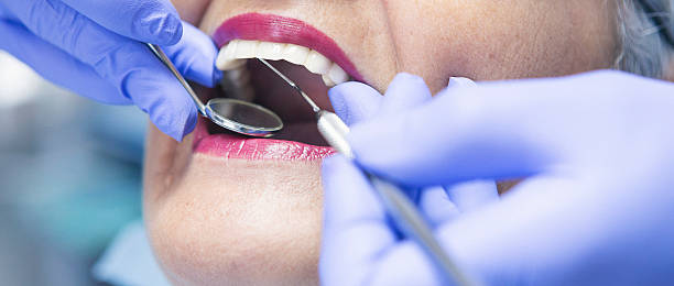 Best Emergency Treatment for Toothache in South Woodstock, CT